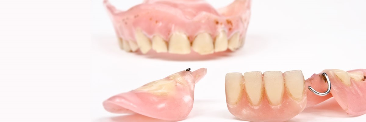 Different Types Of Dentures Washington DC 20575